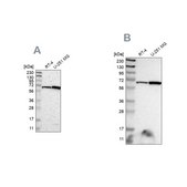 Anti-ME2 antibody produced in rabbit Prestige Antibodies&#174; Powered by Atlas Antibodies, affinity isolated antibody, buffered aqueous glycerol solution