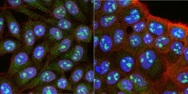 Anti-RRP8 Antibody, clone 5C7.1 clone 5C7.1, from mouse
