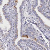 Anti-IDH3G antibody produced in rabbit Ab1, Prestige Antibodies&#174; Powered by Atlas Antibodies, affinity isolated antibody, buffered aqueous glycerol solution
