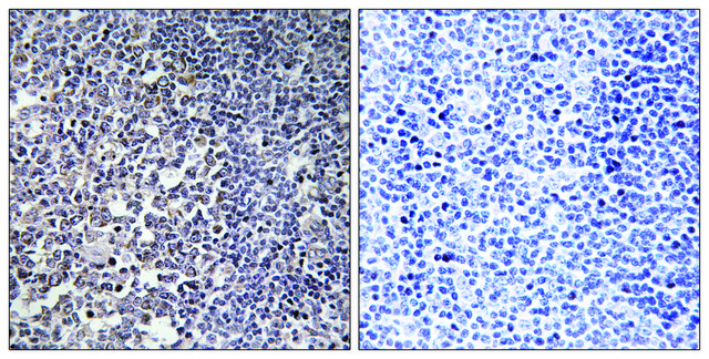 Anti-MRPS16 antibody produced in rabbit affinity isolated antibody