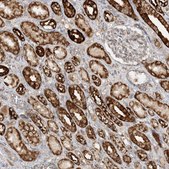 Anti-NDUFAF3 antibody produced in rabbit Prestige Antibodies&#174; Powered by Atlas Antibodies, affinity isolated antibody, buffered aqueous glycerol solution