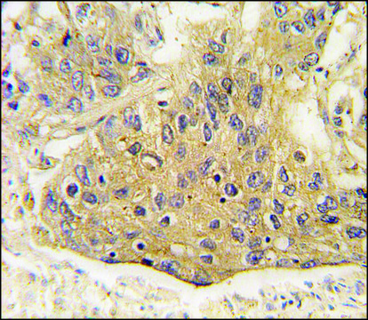 Anti-AARS2 (center) antibody produced in rabbit saturated ammonium sulfate (SAS) precipitated, buffered aqueous solution