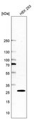 Anti-CSNK2B antibody produced in rabbit Prestige Antibodies&#174; Powered by Atlas Antibodies, affinity isolated antibody, buffered aqueous glycerol solution