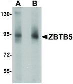 Anti-ZBTB5 antibody produced in rabbit affinity isolated antibody, buffered aqueous solution