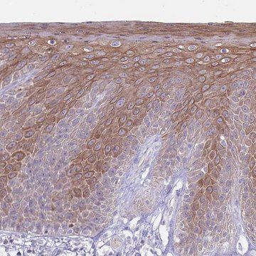 Anti-CDKN2B antibody produced in rabbit Prestige Antibodies&#174; Powered by Atlas Antibodies, affinity isolated antibody, buffered aqueous glycerol solution