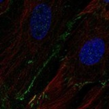 Anti-SCN8A antibody produced in rabbit Prestige Antibodies&#174; Powered by Atlas Antibodies, affinity isolated antibody, buffered aqueous glycerol solution