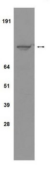 Anti-IGF1 Receptor (CT) Antibody, clone 7G11 clone 7G11, Upstate&#174;, from mouse