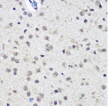 Anti-CTCF antibody produced in rabbit