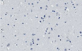 Anti-ROCK2 Antibody, clone 1B20 ZooMAb&#174; Rabbit Monoclonal recombinant, expressed in HEK 293 cells