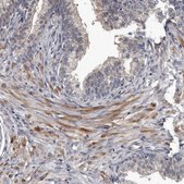 Anti-DHPS antibody produced in rabbit Prestige Antibodies&#174; Powered by Atlas Antibodies, affinity isolated antibody, buffered aqueous glycerol solution