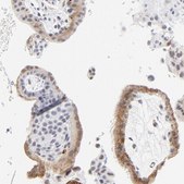 Anti-LTBP2 antibody produced in rabbit affinity isolated antibody, buffered aqueous glycerol solution