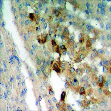Anti-phospho-Fructose 6 Phosphate Kinase (pSer483) antibody produced in rabbit affinity isolated antibody