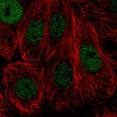 Anti-TONSL antibody produced in rabbit Prestige Antibodies&#174; Powered by Atlas Antibodies, affinity isolated antibody, buffered aqueous glycerol solution