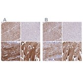 Anti-SYNM antibody produced in rabbit Prestige Antibodies&#174; Powered by Atlas Antibodies, affinity isolated antibody, buffered aqueous glycerol solution