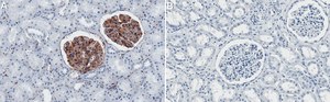 Anti-ILK Antibody, clone 1B22 ZooMAb&#174; Rabbit Monoclonal recombinant, expressed in HEK 293 cells
