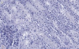 Anti-NOTCH2 Antibody, clone 1B14-5 ZooMAb&#174; Rabbit Monoclonal recombinant, expressed in HEK 293 cells