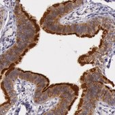 Anti-CDK16 antibody produced in rabbit Prestige Antibodies&#174; Powered by Atlas Antibodies, affinity isolated antibody, buffered aqueous glycerol solution