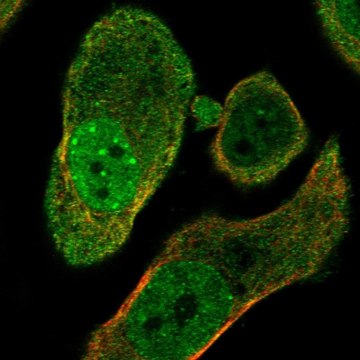 Anti-Parg Antibody Produced In Rabbit Prestige Antibodies&#174; Powered by Atlas Antibodies, affinity isolated antibody, buffered aqueous glycerol solution