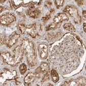 Anti-ANXA11 antibody produced in rabbit Prestige Antibodies&#174; Powered by Atlas Antibodies, affinity isolated antibody, buffered aqueous glycerol solution