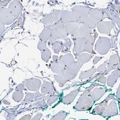 Anti-AHNAK2 antibody produced in rabbit Prestige Antibodies&#174; Powered by Atlas Antibodies, affinity isolated antibody, buffered aqueous glycerol solution