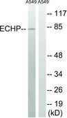 Anti-EHHADH antibody produced in rabbit affinity isolated antibody
