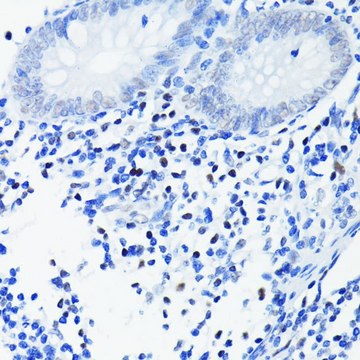 Anti- PARP1 antibody produced in rabbit