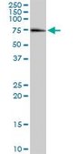 Anti-GRHL2 antibody produced in mouse purified immunoglobulin, buffered aqueous solution