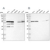 Anti-CCT8 antibody produced in rabbit Prestige Antibodies&#174; Powered by Atlas Antibodies, affinity isolated antibody, buffered aqueous glycerol solution
