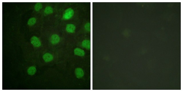 Anti-DNA-PK antibody produced in rabbit affinity isolated antibody