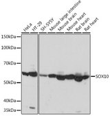 Anti-SOX10 Antibody, clone 2V5D6, Rabbit Monoclonal