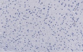 Anti-GluR1 Antibody, clone RH95 ZooMAb&#174; Mouse Monoclonal recombinant, expressed in HEK 293 cells