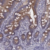 Anti-PRKCZ antibody produced in rabbit Prestige Antibodies&#174; Powered by Atlas Antibodies, affinity isolated antibody, buffered aqueous glycerol solution