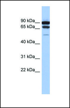 Anti-TP73 antibody produced in rabbit affinity isolated antibody