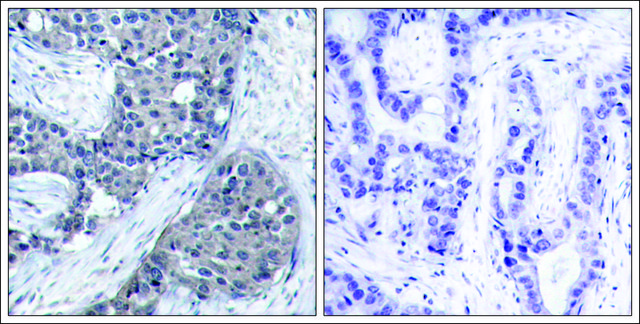 Anti-phospho-EIF4E (pSer209) antibody produced in rabbit affinity isolated antibody