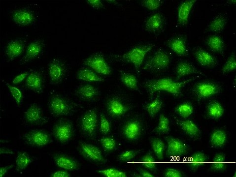 Monoclonal Anti-UBE2L3 antibody produced in mouse clone 3B7, purified immunoglobulin, buffered aqueous solution