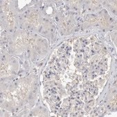 Anti-TOP2A antibody produced in rabbit Prestige Antibodies&#174; Powered by Atlas Antibodies, affinity isolated antibody, buffered aqueous glycerol solution, Ab2