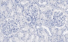Anti-ZO-1 Antibody, clone 4E14 ZooMAb&#174; Rabbit Monoclonal recombinant, expressed in HEK 293 cells