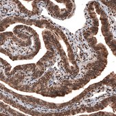 Monoclonal Anti-GAPDH antibody produced in mouse Prestige Antibodies&#174; Powered by Atlas Antibodies, clone CL3266, purified immunoglobulin, buffered aqueous glycerol solution