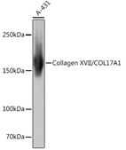 Anti-Collagen XVII/COL17A1 Antibody, clone 8W2C8, Rabbit Monoclonal