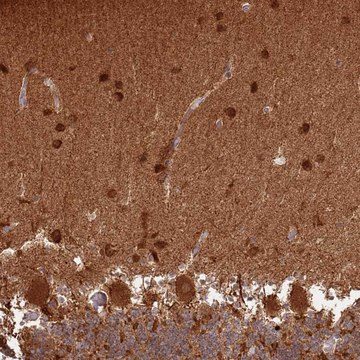 Anti-CNPY1 antibody produced in rabbit Prestige Antibodies&#174; Powered by Atlas Antibodies, affinity isolated antibody, buffered aqueous glycerol solution