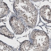Anti-PUM3 antibody produced in rabbit Prestige Antibodies&#174; Powered by Atlas Antibodies, affinity isolated antibody, buffered aqueous glycerol solution
