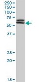 Anti-TAF6 antibody produced in rabbit purified immunoglobulin, buffered aqueous solution