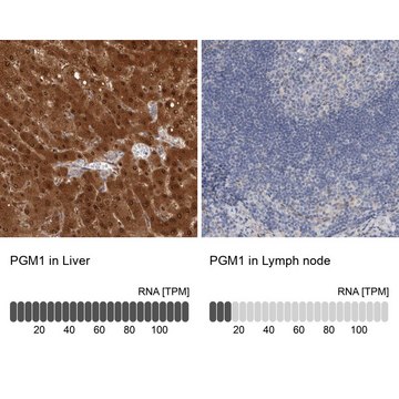 Anti-PGM1 antibody produced in rabbit Prestige Antibodies&#174; Powered by Atlas Antibodies, affinity isolated antibody, buffered aqueous glycerol solution, Ab1