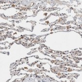 Anti-KLHL6 antibody produced in rabbit Prestige Antibodies&#174; Powered by Atlas Antibodies, affinity isolated antibody, buffered aqueous glycerol solution