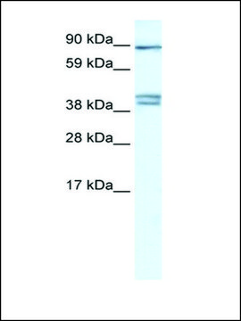 Anti-CLCNKB (AB1) antibody produced in rabbit affinity isolated antibody