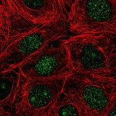 Anti-NUDT16 antibody produced in rabbit Prestige Antibodies&#174; Powered by Atlas Antibodies, affinity isolated antibody, buffered aqueous glycerol solution