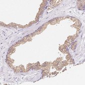 Anti-SOAT1 antibody produced in rabbit Prestige Antibodies&#174; Powered by Atlas Antibodies, affinity isolated antibody, buffered aqueous glycerol solution