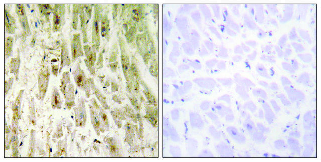 Anti-SMAD1 antibody produced in rabbit affinity isolated antibody