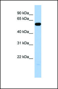 Anti-ILDR1 antibody produced in rabbit affinity isolated antibody