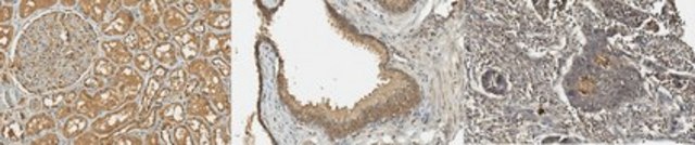 Anti-PCSK9 Antibody, clone 9B3.1 culture supernatant, clone 9B3.1, from mouse